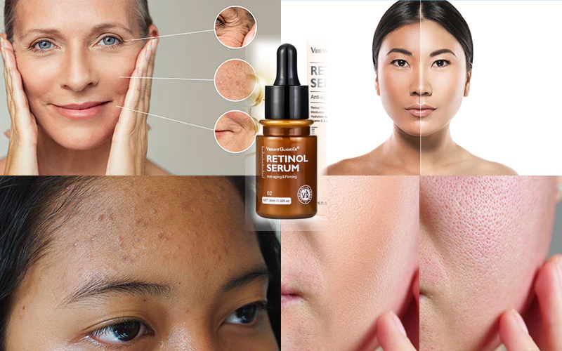 Ikuti Petunjuk Yang Benar Menggunakan Retinol Bahan Dasar Skincare