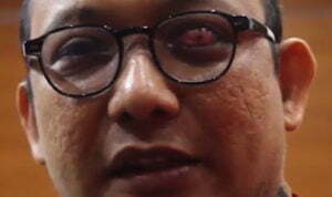 Yang Aneh dari Sidang Pelaku Penyiram Air Keras kepada Novel Baswedan