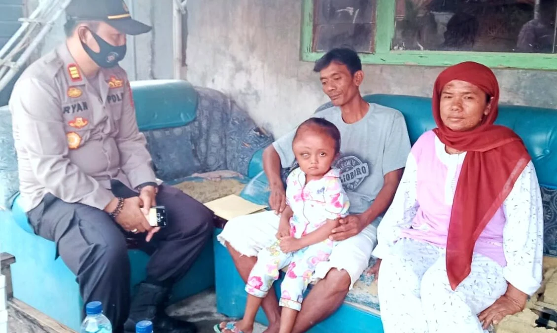 Kapolsek Bantu Anak Penderita Kanker Mata