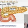 diabetes di usia muda lebih berbahaya