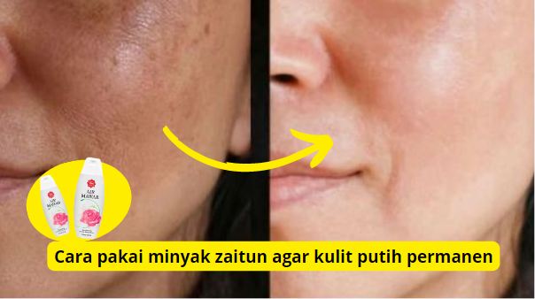 Caa menghilangkan flek hitam teampuh dengan 1 bahan.