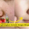 Cara paka masker tomat dan minyak zaitun agar wajah bebas komedo.