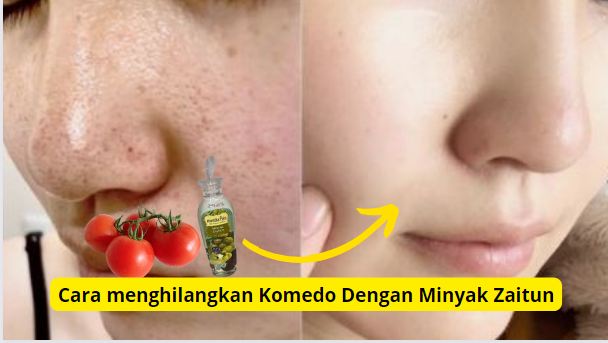 Cara paka masker tomat dan minyak zaitun agar wajah bebas komedo.