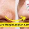 Cara menghilangkan komedo dengan air mawar viva dan garam.