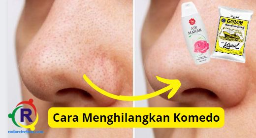 Cara menghilangkan komedo dengan air mawar viva dan garam.