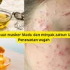 Cara buat maske madu dan minyak zaitun agar wajah bebas jerawat.