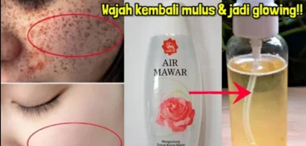 Air mawar viva untuk flek hitam