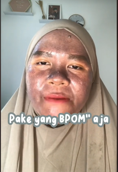 salah pilih skincare