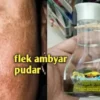 Menghilangkan flek hitam dengan minyak zaitun