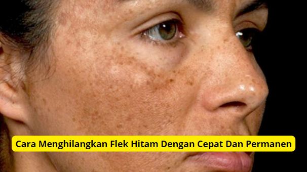 Cara menghilangkan flek hitam dengan bahan alami.