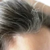 APAKAH UBAN RAMBUT YANG SUDAH DI CABUT TUMBUH KEMBALI ??? INILAH FAKTANYA