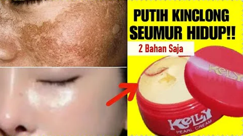 krim kelly dicampur air mawar viva