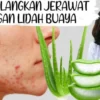 lidah buaya ampuh atasi jerawat