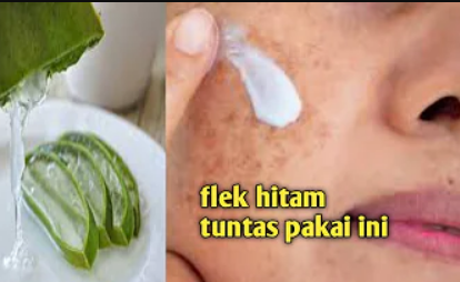 masker lidah buaya