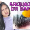 CARA MENGHILANGKAN KUTU RAMBUT YANG EFEKTIF DENGAN BERBAGAI CARA BISA