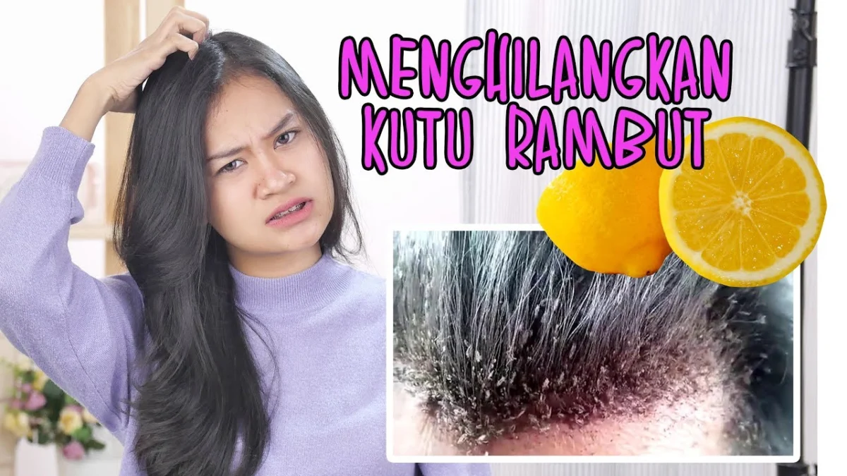 CARA MENGHILANGKAN KUTU RAMBUT YANG EFEKTIF DENGAN BERBAGAI CARA BISA