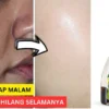 Minyak Zaitun Sebagai Solusi Menghilangkan Flek Hitam