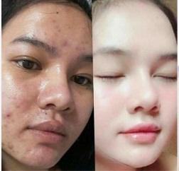 serum pemutih alami dari air mawar viva