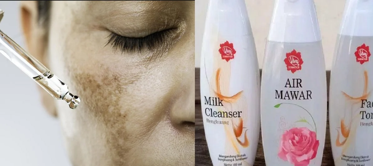 air mawar viva untuk hilangkan flek hitam