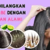 Bahan alami penghilang ketombe yang membandel