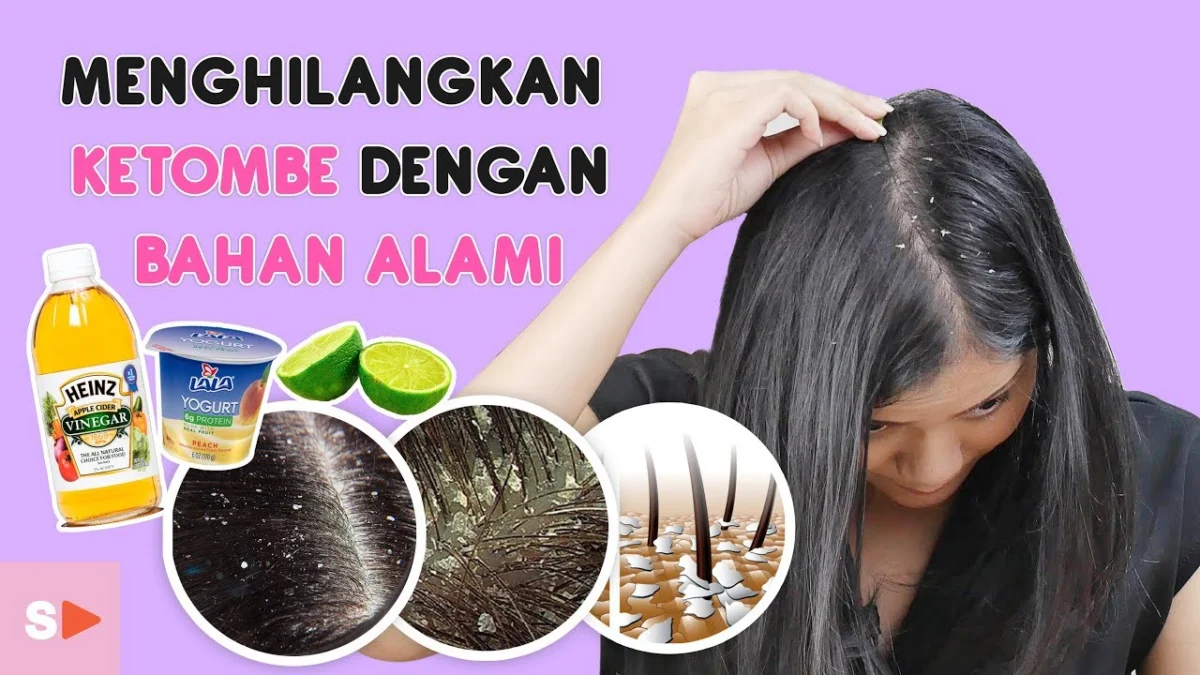 Bahan alami penghilang ketombe yang membandel