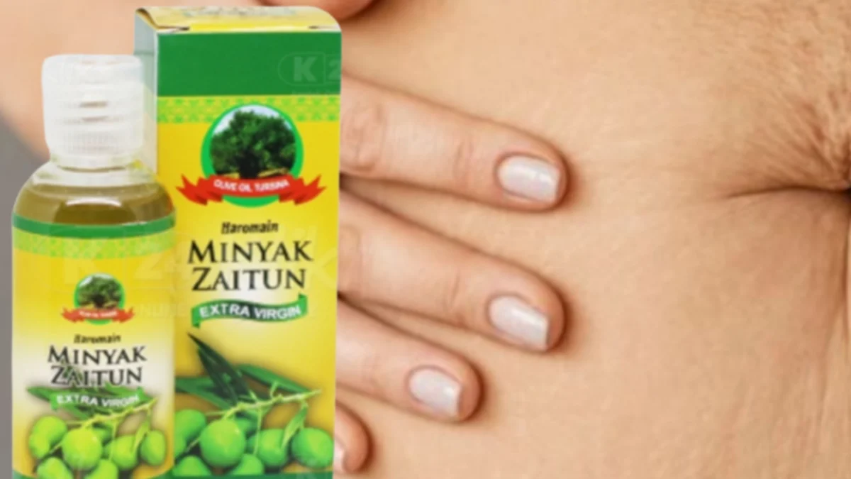 Menghilangkan Stretch Mark dengan minyak zaitun