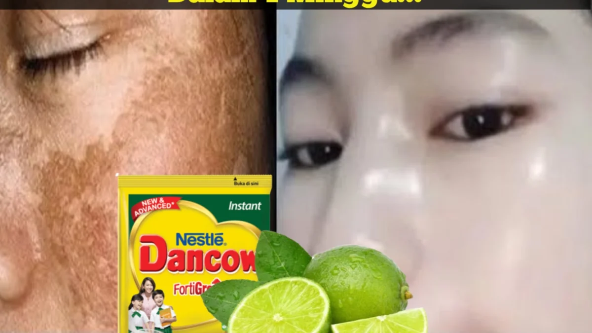 Masker susu Dancow campur jeruk nipis