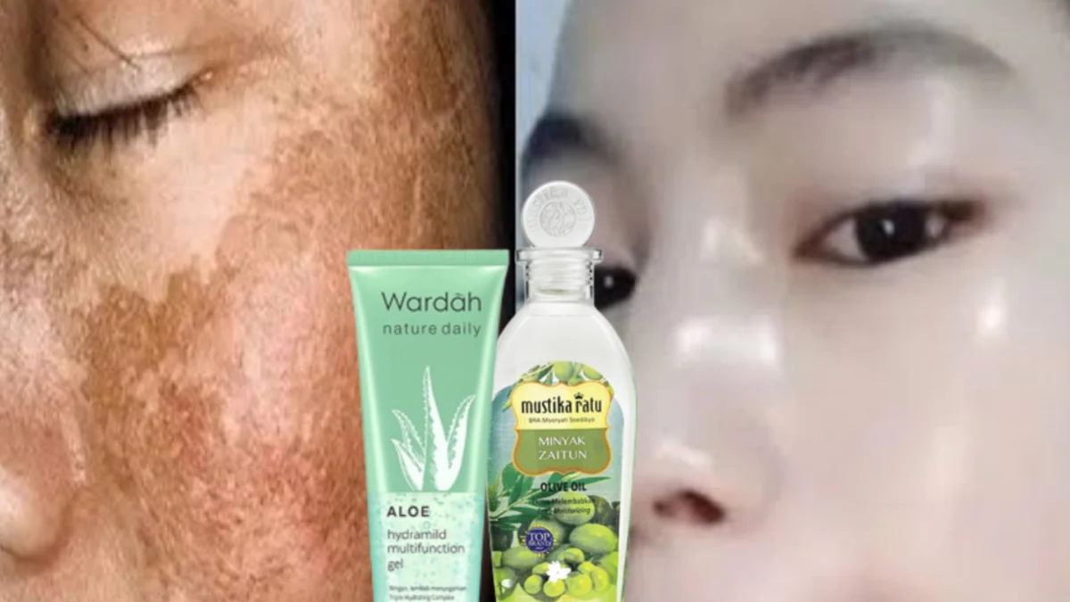 Masker lidah buaya dan minyak zaitun