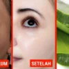 manfaat dan tips pemakaian Masker Lidah Buaya