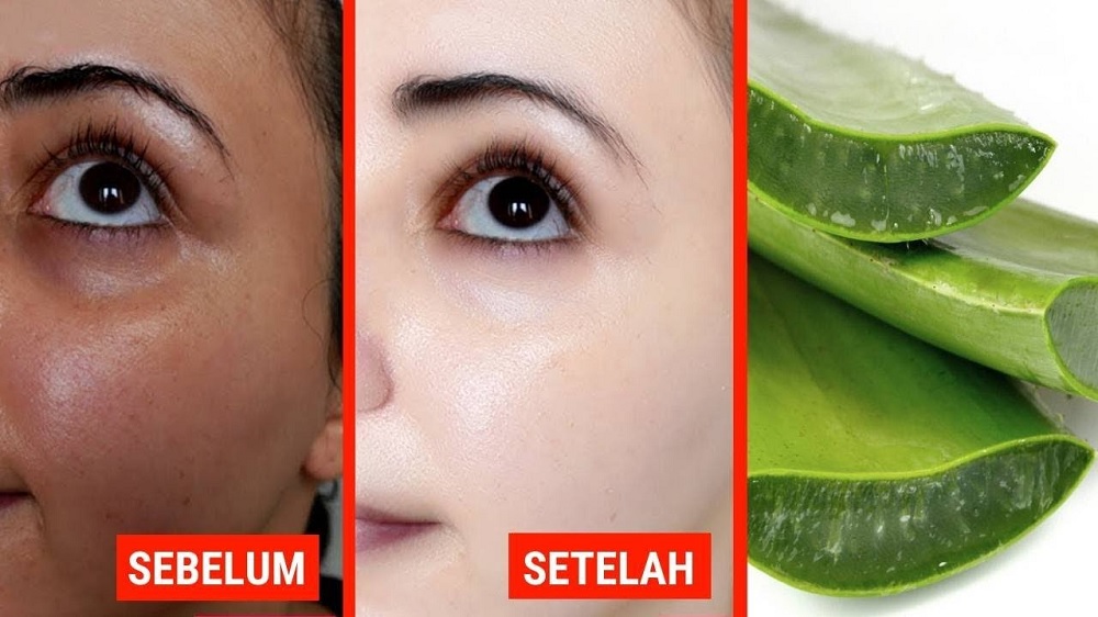 manfaat dan tips pemakaian Masker Lidah Buaya