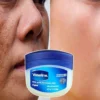 Cara pakai vaseline untuk wajah.