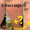 Masker minyak zaitun.