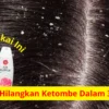 Air mawar untuk ketombe rambut.