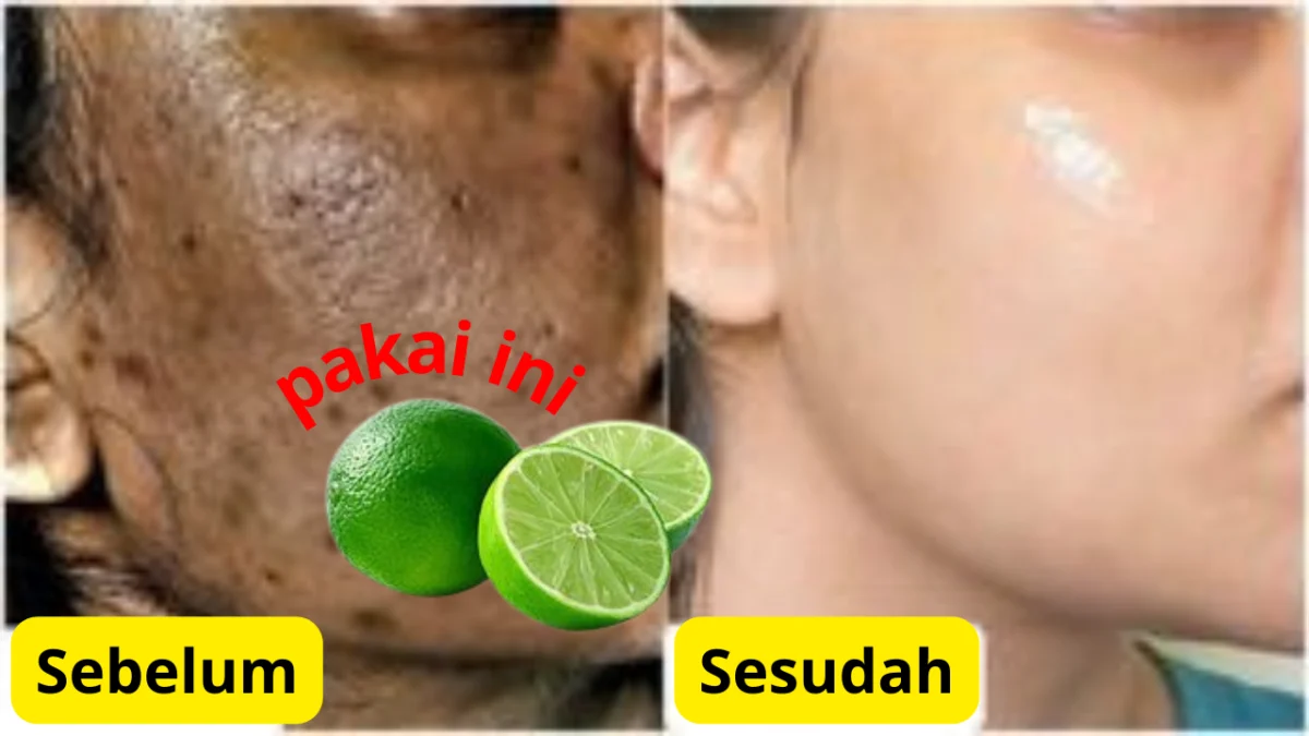 Cara memutihkan wajah dengan jeruk nipis.