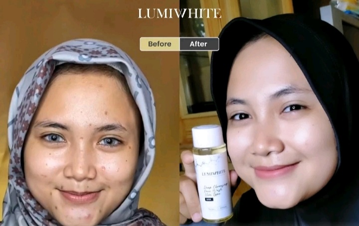 Inilah Harga Produk Lumiwhite Skincare