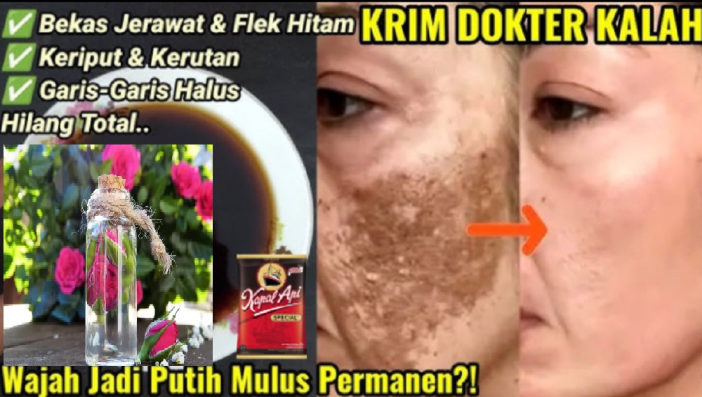 kopi hitam dan air mawar viva