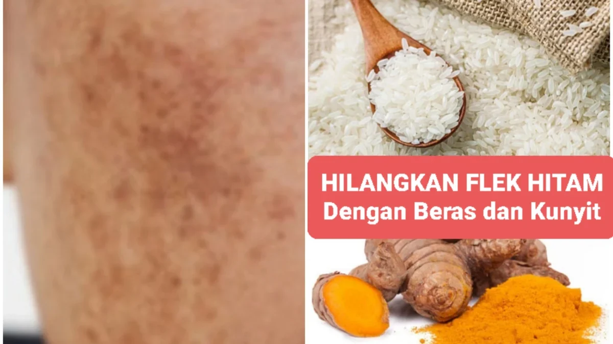 Cara hilangkan flek hitam pakai racikan beras + kunyit