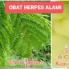 Cara Membuat Obat Herpes Alami dari Tanaman