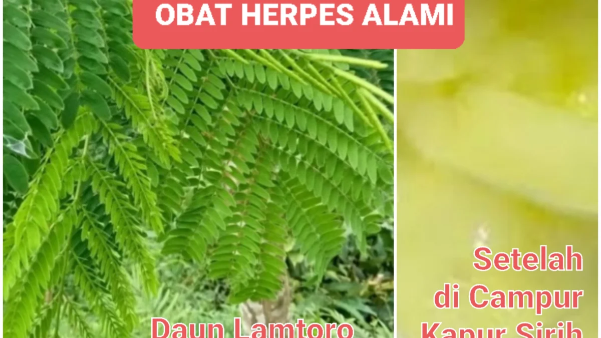 Cara Membuat Obat Herpes Alami dari Tanaman