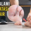 Cara Menghilangkan Kutu Air Pada Kulit Secara Cepat Dan Mudah